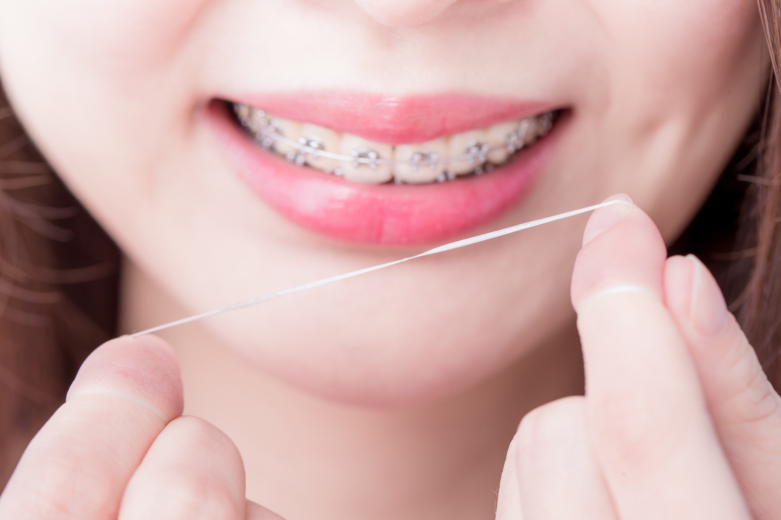 6 ways to clean your teeth when you have braces